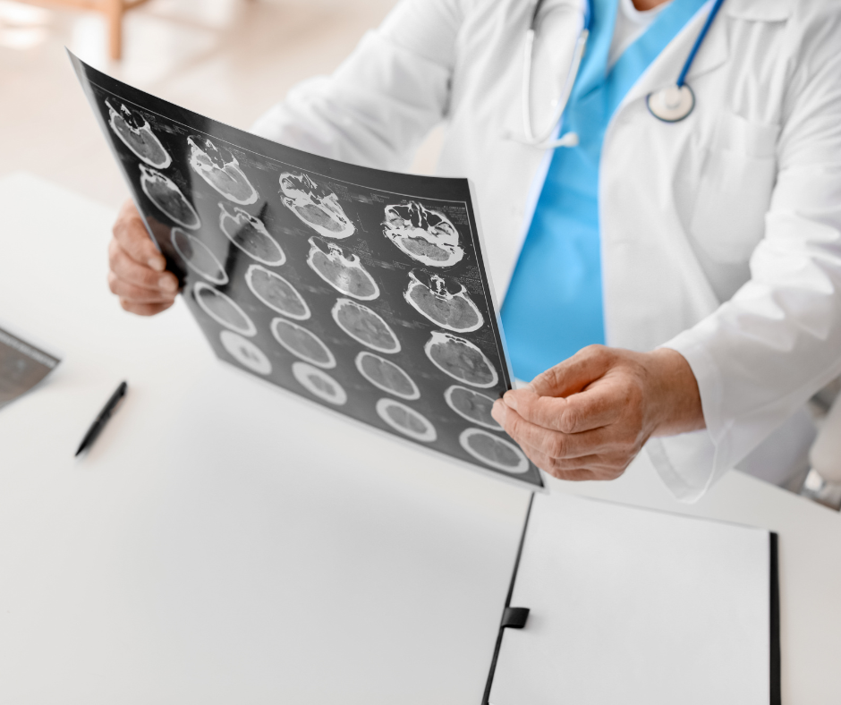 Huntsville brain injury lawyers