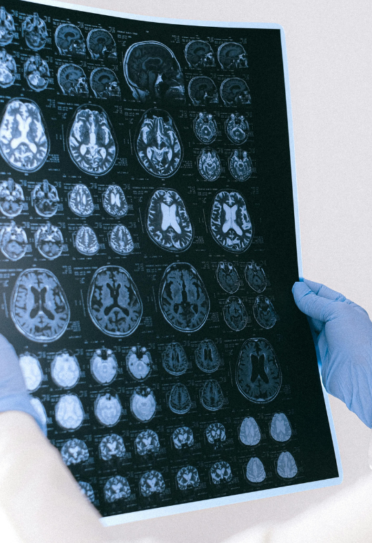 Alabama traumatic brain injury lawyers